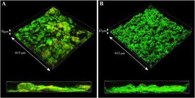 Corrosion of Carbon Steel by Shewanella chilikensis DC57 Under Thiosulphate and Nitrate Reducing Conditions